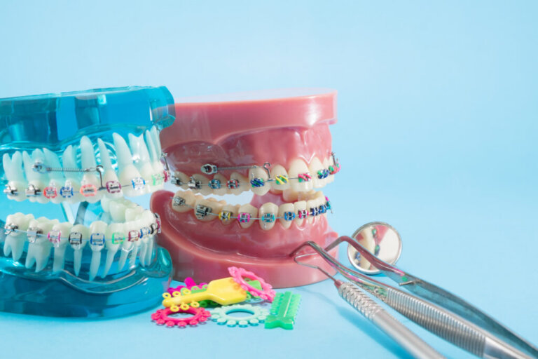 Orthodontic,Model,And,Dentist,Tool,-,Demonstration,Teeth,Model,Of