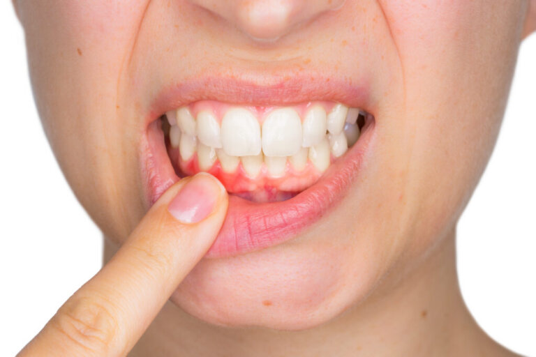 Closeup,Portrait,Of,Young,Woman,Showing,With,His,Finger,Inflamed