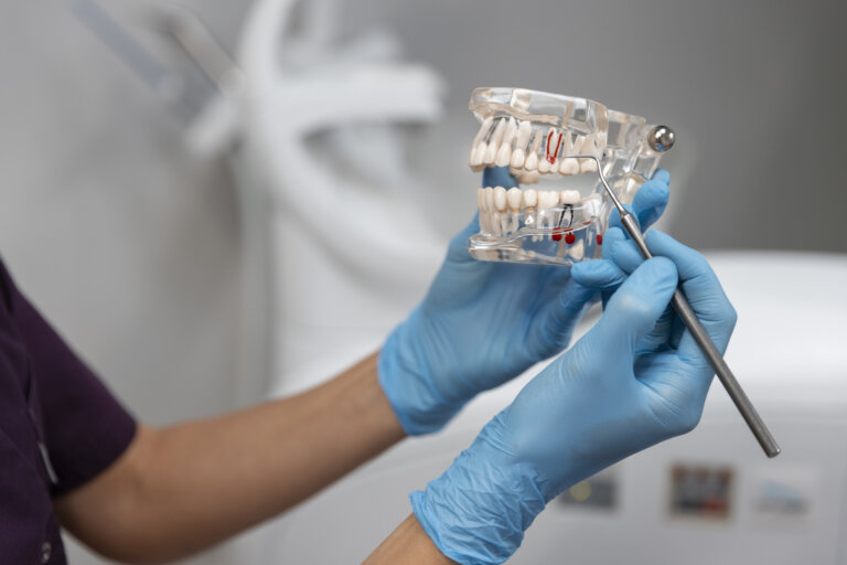 Отек после имплантации зубов